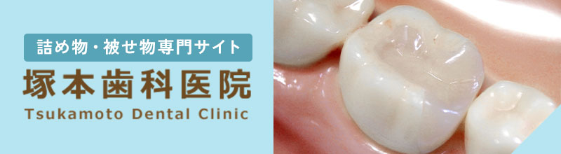 詰め物・被せ物専門サイト